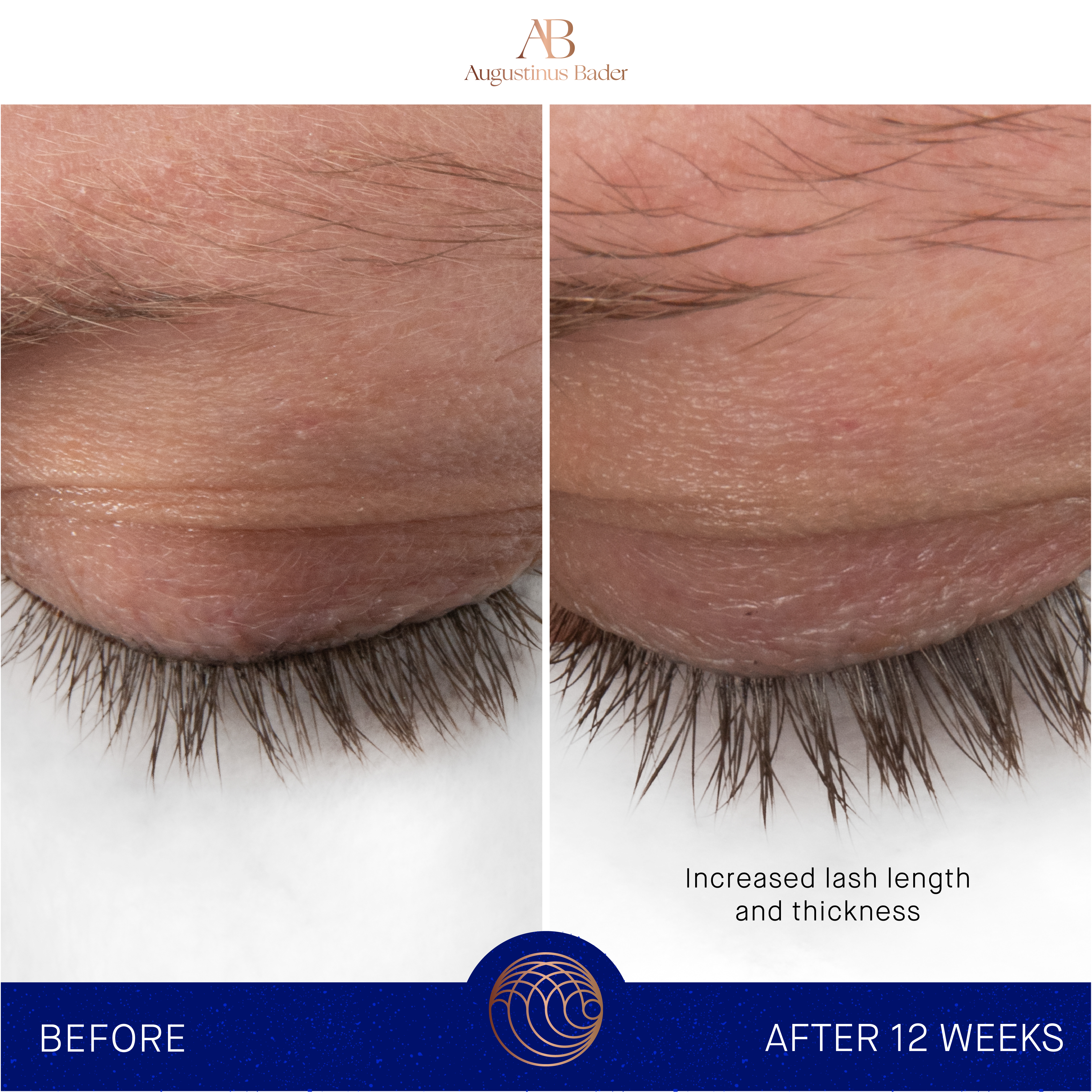 Augustinus Bader THE EYEBROW & LASH ENHANCING SERUM